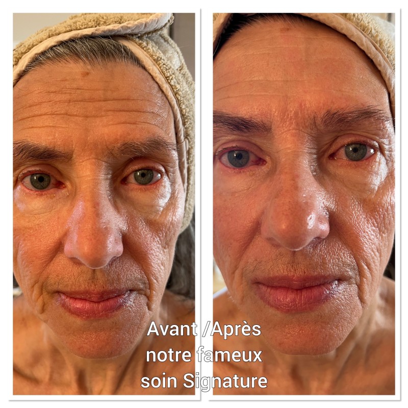 Notre soin SIGNATURE radiofréquence visage et cou pour raffermir et repupler la peau un anti-âge global à l’institut de beauté à Strasbourg, proche Robertsau 