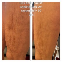 Notre zone d'activité pour ce service Centre esthétique avec soins high tech pour perdre du poids