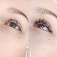 Notre zone d'activité pour ce service Epilation du dos et du torse pour homme