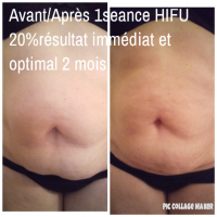 Notre zone d'activité pour ce service Esthéticienne palpé rouler manuel à