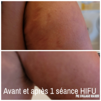 Nos prestations sur le secteur de proche de Schiltigheim