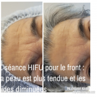 Notre zone d'activité pour ce service Meilleur soin anti-âge en institut de beauté