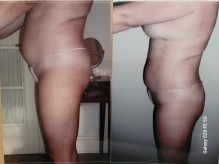 Nos prestations sur le secteur de proche de Schiltigheim