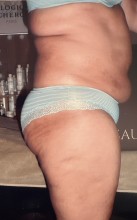 Nos prestations sur le secteur de Neudorf quartier Strasbourg