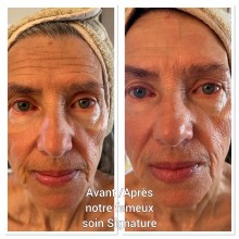 Nos prestations sur le secteur de Neudorf quartier Strasbourg