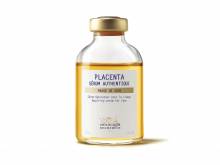 Nos prestations sur le secteur de Orangerie à Strasbourg